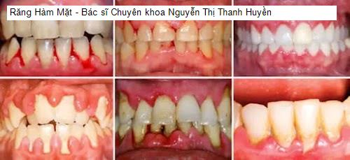 Yến Sào Hải Phòng - Gợi ý 17 Nha Khoa tốt nhất khu vực Huyện Kiến Thuỵ